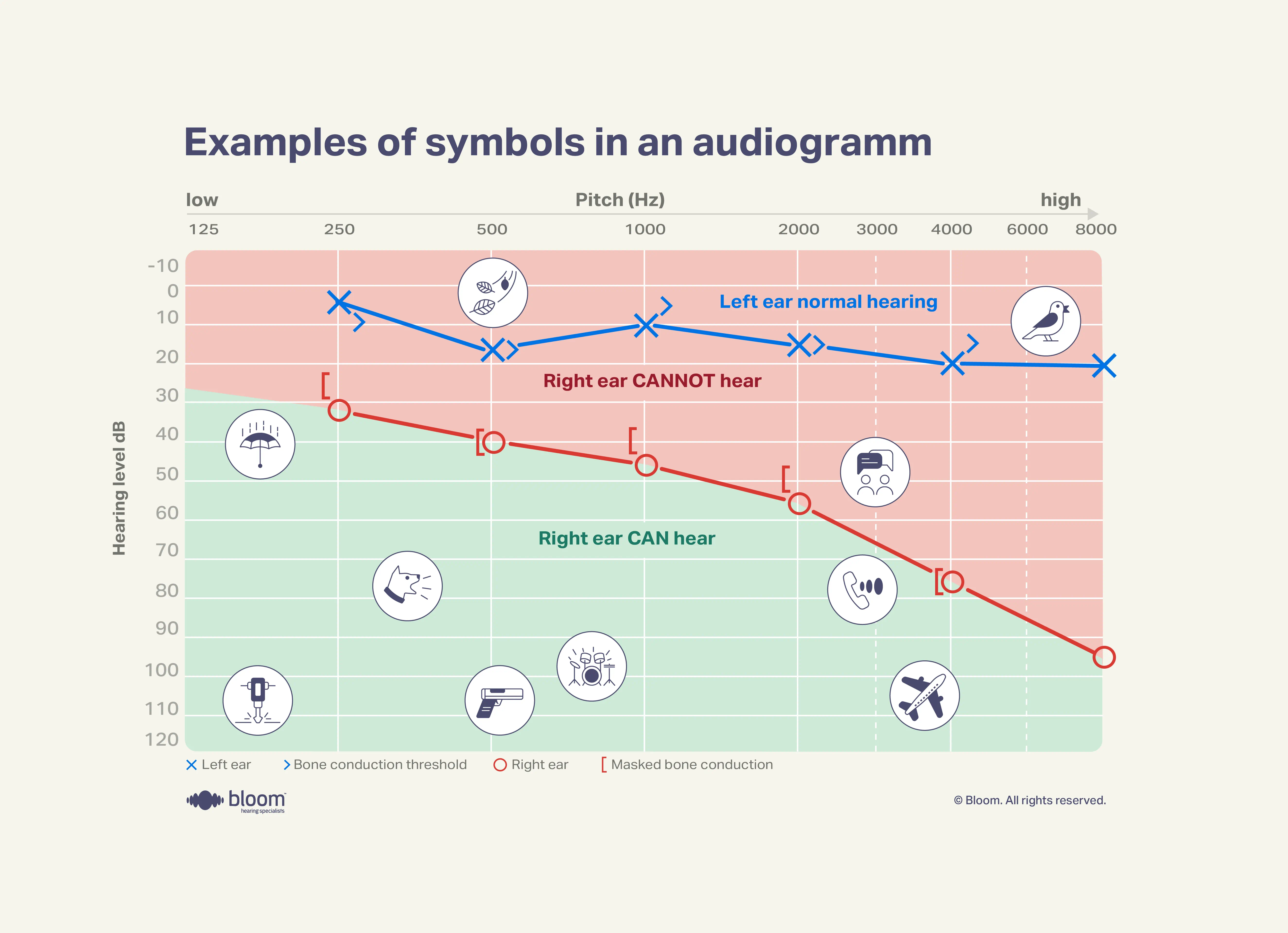 Ilustração mostrando símbolos comuns usados em audiogramas para testes auditivos.