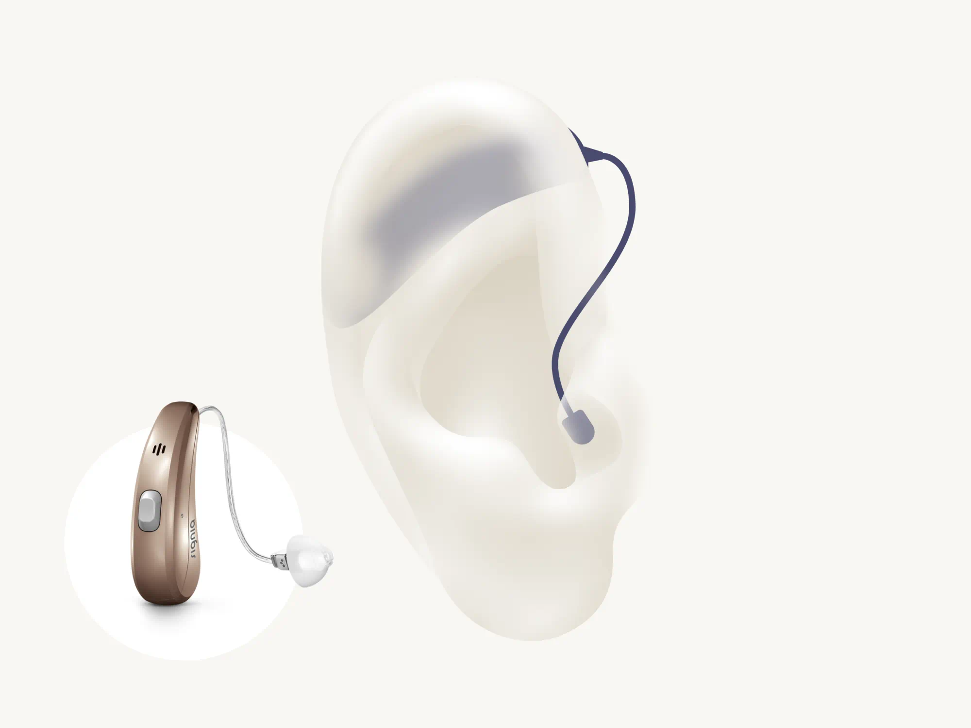 types of hearing-aids-bte-signia-pure-cng-nx-4x3